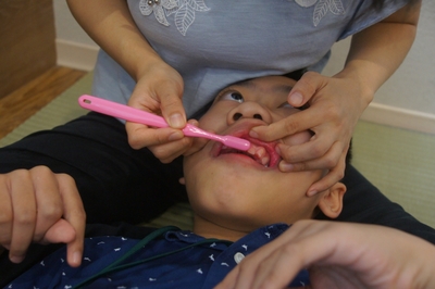 比賽家長依貝氏刷牙法的潔牙技巧，以兩顆、兩顆慢慢刷